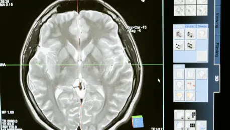 Intracranial Teratoma in Adults: A Diagnostic Challenge?