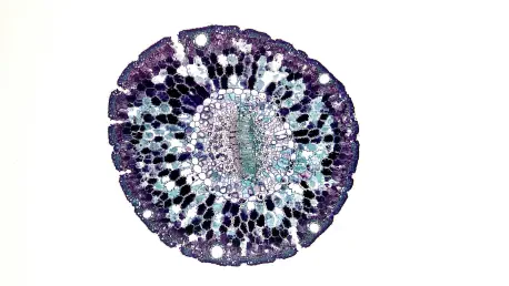 Stem Cell Trial Frees Kidney Recipients from Lifelong Meds