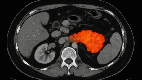 Advanced Model Predicts Pancreatic Cancer Survival with CT and MRI