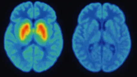 Brain Imaging Advances Transform Parkinson’s Diagnosis