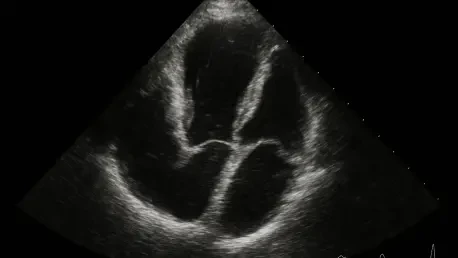 How Is Esaote Revolutionizing Cardiac Ultrasound at ESC 2025?