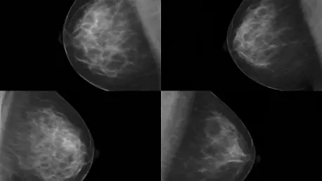 Mammograms Boost Survival Rates for Women Over 80