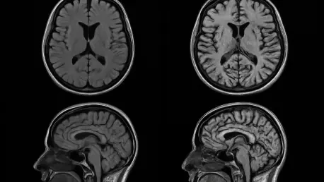 MRI Age Clocks Uncover Unique Organ Aging and Disease Risks