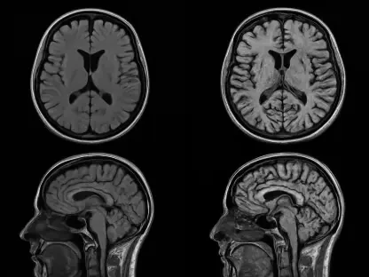 MRI Age Clocks Uncover Unique Organ Aging and Disease Risks