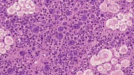 Rare Pancreatic Hodgkin Lymphoma: A Diagnostic Challenge