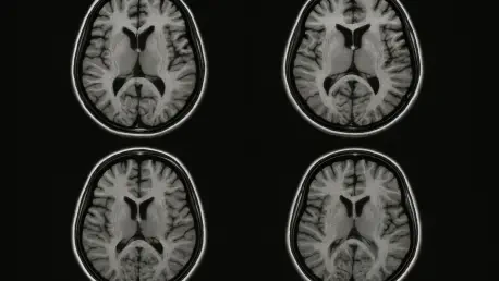 University of Arizona Unveils AI-Powered MRI Systems