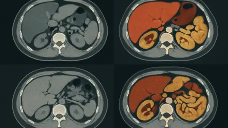 AI Predicts Fall Risk Using Routine Abdominal Scans